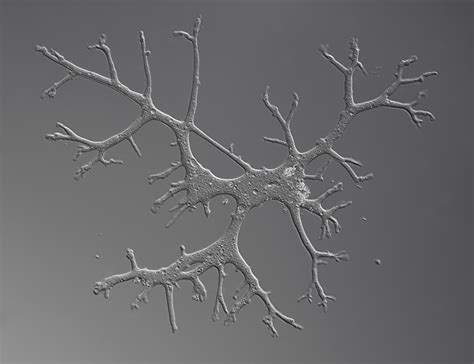  Leptomyxa! Een eencellige held met een liefde voor bacteriën en een talent voor verandering