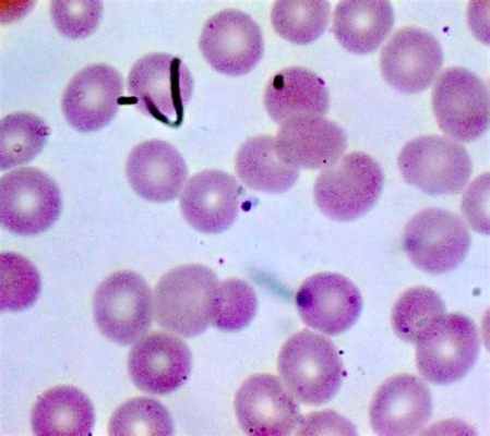  Babesia: Een microscopisch wezen dat door de bloedbaan zweeft!