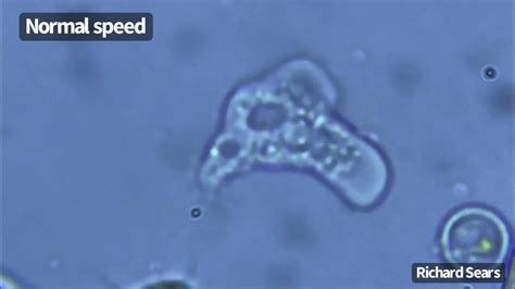  Naegleria: Een Microscopische Killer die zich Door de Lucht Beweegt en Voor een Goudgerij Gevoel Zorg Draagt!