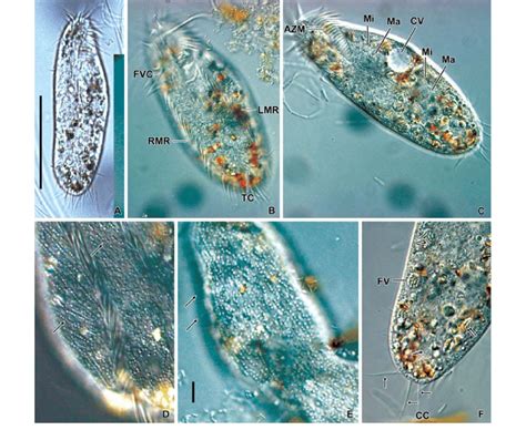  Oxytricha! Een Microscopische Meester van Morfologie en Celdeling